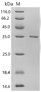 Human Apoptosis-enhancing nuclease (AEN), partial Recombinant Protein, C-His, E.coli, C-terminal 6xHis-tagged, 31.0 kDa, purity >≥ 95% as determined by SDS-PAGE.