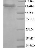 Human D-glucuronyl C5-epimerase (GLCE), partial Recombinant Protein - BioCrest Sci