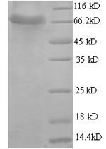 Human D-glucuronyl C5-epimerase (GLCE), partial Recombinant Protein, Homo sapiens (Human), E.coli, N-terminal 6xHis-tagged, 70.9 kDa, purity >≥ 90% as determined by SDS-PAGE.