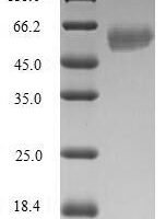 Human DNA repair protein RAD51 homolog 4 (RAD51D) Recombinant Protein - BioCrest Sci