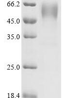 Human Synaptic vesicle glycoprotein 2C（SV2C), partial Recombinant Protein, C-hFc1 - BioCrest Sci