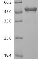 Human Carbonic anhydrase 9 (CA9), partial Recombinant Protein - BioCrest Sci