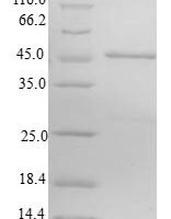 Human Cysteine-rich hydrophobic domain 2 protein (CHIC2) Recombinant Protein, N-GST - BioCrest Sci
