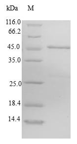 Human Cysteine-rich hydrophobic domain 2 protein (CHIC2) Recombinant Protein, N-GST, Homo sapiens (Human), E.coli, N-terminal GST-tagged, 46.3 kDa, purity >≥ 90% as determined by SDS-PAGE.