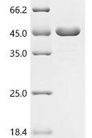 Mycobacterium tuberculosis Transporter PPE51 (PPE51) Recombinant Protein - BioCrest Sci