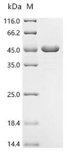 Mycobacterium tuberculosis Transporter PPE51 (PPE51) Recombinant Protein, Mycobacterium tuberculosis (strain CDC 1551 / Oshkosh), E.coli, N-terminal 6xHis-tagged, 44.0 kDa, purity >≥ 85% as determined by SDS-PAGE.