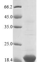 Sheep Beta-2-microglobulin (B2M) Recombinant Protein - BioCrest Sci