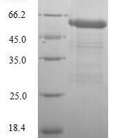 Human Dihydrolipoyllysine-residue acetyltransferase component of pyruvate dehydrogenase complex, mitochondrial (DLAT), partial Recombinant Protein, N-His - BioCrest Sci