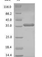 Human Homeobox protein NANOG (NANOG) Recombinant Protein - BioCrest Sci