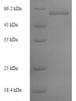Arabidopsis thaliana Lycopene beta cyclase, chloroplastic (LCY1) Recombinant Protein, N-His-SUMO - BioCrest Sci