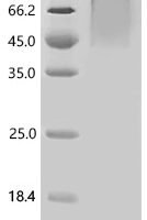 Rat Fibroblast growth factor receptor 1 (Fgfr1),partial Recombinant Protein - BioCrest Sci