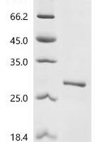 Human Prostaglandin-H2 D-isomerase (PTGDS) (145-156:MATLYSRTQTPR→Missing) Recombinant Protein - BioCrest Sci