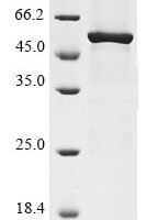 Human Aminopeptidase N (ANPEP), partial Recombinant Protein - BioCrest Sci