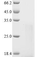 Human Interleukin-21 (IL21), partial Recombinant Protein, C-His, aa 30–162, Yeast - BioCrest Sci