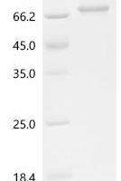 Human Heterogeneous nuclear ribonucleoprotein D0（HNRNPD) Recombinant Protein - BioCrest Sci