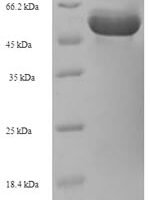 Rhizobium meliloti UDP-glucuronate 5'-epimerase (lspL) Recombinant Protein - BioCrest Sci