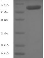 Human Src kinase-associated phosphoprotein 1 (SKAP1) Recombinant Protein - BioCrest Sci