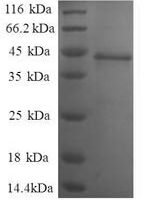 Human Nuclear nucleic acid-binding protein C1D (C1D), partial Recombinant Protein - BioCrest Sci
