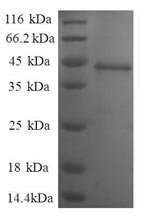 Human Nuclear nucleic acid-binding protein C1D (C1D), partial Recombinant Protein, Homo sapiens (Human), E.coli, N-terminal GST-tagged, 42.4 kDa, purity >≥ 90% as determined by SDS-PAGE.