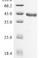 Human Prostatic acid phosphatase (ACP3), partial Recombinant Protein, N-10His - BioCrest Sci