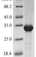 Triticum aestivum Trypsin/alpha-amylase inhibitor CMx2 Recombinant Protein - BioCrest Sci