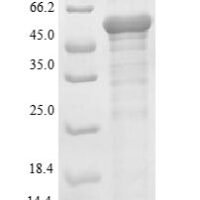Mouse Heterogeneous nuclear ribonucleoproteins A2/B1 (Hnrnpa2b1) Recombinant Protein, N-His-SUMO - BioCrest Sci