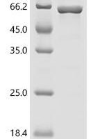 Arabidopsis thaliana Protoporphyrinogen oxidase 2,chloroplastic/mitochondrial (PPOX2) Recombinant Protein - BioCrest Sci