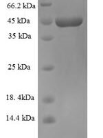Zaire ebolavirus Super small secreted glycoprotein (GP) Recombinant Protein - BioCrest Sci