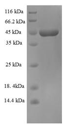 Zaire ebolavirus Super small secreted glycoprotein (GP) Recombinant Protein, Zaire ebolavirus (strain Kikwit-95) (ZEBOV) (Zaire Ebola virus), E.coli, N-terminal 6xHis-SUMO-tagged, 45.7 kDa, purity >≥ 90% as determined by SDS-PAGE.