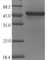 Vibrio cholerae serotype O1 Zona occludens toxin (zot) Recombinant Protein - BioCrest Sci
