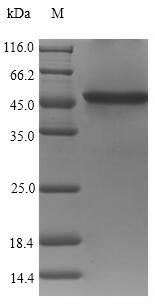 Vibrio cholerae serotype O1 Zona occludens toxin (zot) Recombinant Protein, Vibrio cholerae serotype O1 (strain ATCC 39315 / El Tor Inaba N16961), E.coli, N-terminal 10xHis-tagged, 48.4 kDa, purity >≥ 90% as determined by SDS-PAGE.