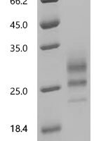 Human Interleukin-7 (IL7) Recombinant Protein - BioCrest Sci