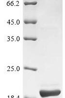 Influenza A virus Protein PB1-F2 (PB1) Recombinant Protein - BioCrest Sci
