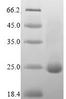 Human Dedicator of cytokinesis protein 8 (DOCK8), partial Recombinant Protein, N-His - BioCrest Sci