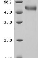 Human T-cell antigen CD7 (CD7), partial Recombinant Protein, N-10His/C-Myc - BioCrest Sci