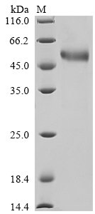 Human T-cell antigen CD7 (CD7), partial Recombinant Protein, N-10His/C-Myc, Homo sapiens (Human), Mammalian cell, N-terminal 10xHis-tagged and C-terminal Myc-tagged, 21.5 kDa, purity >≥ 85% as determined by SDS-PAGE.