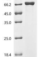 Human Bifunctional purine biosynthesis protein ATIC (ATIC) Recombinant Protein - BioCrest Sci