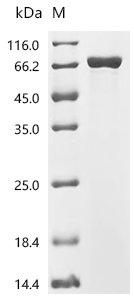 Human Bifunctional purine biosynthesis protein ATIC (ATIC) Recombinant Protein, Homo sapiens (Human), E.coli, N-terminal 10xHis-tagged and C-terminal Myc-tagged, 72.1 kDa, purity >≥ 90% as determined by SDS-PAGE.