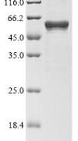 Escherichia coli Transposase for transposon Tn5 (tnpA) (E54K,L372P) Recombinant Protein, Tag-Free - BioCrest Sci