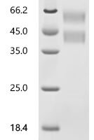 Human Transforming growth factor beta-1 proprotein (TGFB1) Recombinant Protein, N-10His-Myc - BioCrest Sci