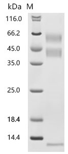 Human Transforming growth factor beta-1 proprotein (TGFB1) Recombinant Protein, N-10His-Myc, Homo sapiens (Human), Mammalian cell, N-terminal 10xHis-Myc-tagged, 46.1 kDa, purity >≥ 95% as determined by SDS-PAGE.