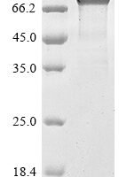 Human Mucin-16 (MUC16), partial Recombinant Protein - BioCrest Sci