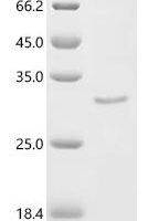 Mouse Dystrophin (Dmd), partial Recombinant Protein, C-10His - BioCrest Sci