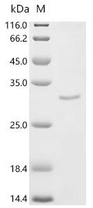 Mouse Dystrophin (Dmd), partial Recombinant Protein, C-10His, Mus musculus (Mouse), Mus musculus (Mouse), C-terminal 10xHis-tagged, 29.4 kDa, purity >≥ 90% as determined by SDS-PAGE.