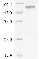 Hepatitis B virus genotype C subtype adr Capsid protein (C) Recombinant Protein - BioCrest Sci