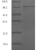 Mouse Serum response factor (Srf) Recombinant Protein - BioCrest Sci