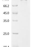 Human Long-chain-fatty-acid--CoA ligase 1 (ACSL1), partial, Biotinylated Recombinant Protein - BioCrest Sci