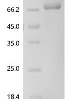 Human Killer cell immunoglobulin-like receptor 3DL3 (KIR3DL3), partial Recombinant Protein, C-hFc1 - BioCrest Sci