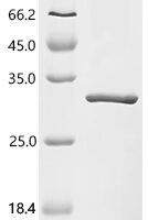Human GTPase KRas (G12V), partial Recombinant Protein - BioCrest Sci