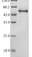 Mouse Protein Wnt-6 (Wnt6) Recombinant Protein - BioCrest Sci